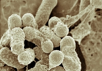 Disease-causing bacteria can spread like wildfire