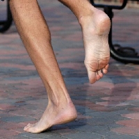 Barefoot running injuries are hobbling but preventable