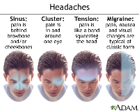 Knowing how to get rid of tension headache pain can save your day