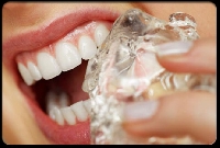Ruining your teeth is on the list of what can eating ice do to you