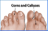 Tips for foot comfort can save you from painful foot problems