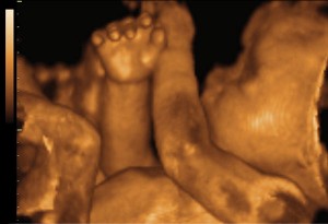 One of the top ten Mother's Day gifts for Mom's-to-be