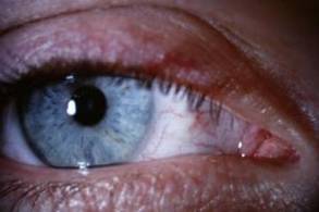 A list of the top ten ways to avoid eye strain
