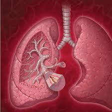 A list of the top ten diseases of the elderly
