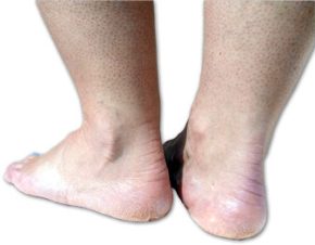 A list of the top ten ankle exercises