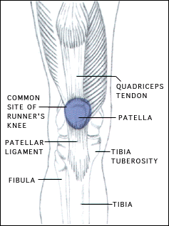 runners knee