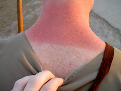 Sunscreen