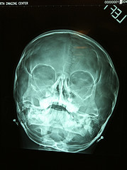 Tumors