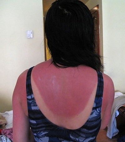 Wear Sunscreen