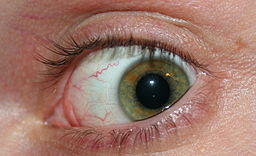 Rapid Eye Movement Behavior Disorder