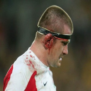Injury
