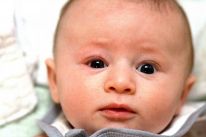 baby with acne