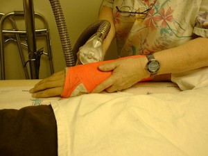 Sprains & Broken Bones