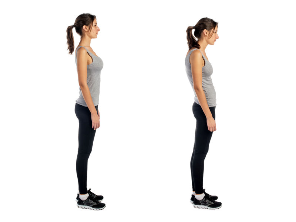 poor posture